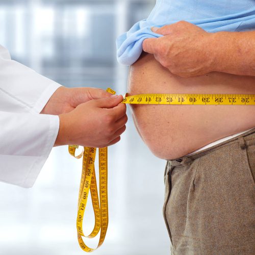 Cancro al rene correlazione obesità