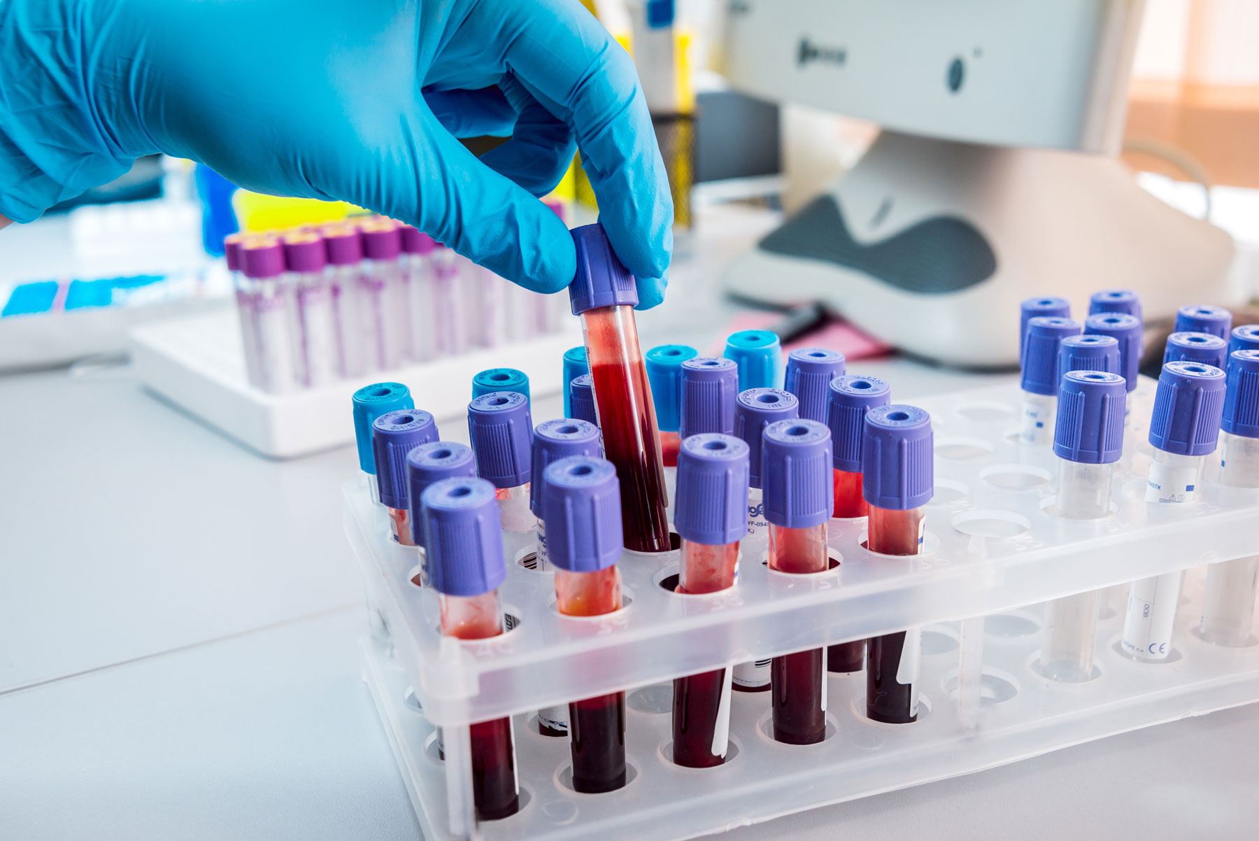 Le analisi del sangue prezioso alleato della salute Centro Clinico Chimico Le analisi del sangue prezioso alleato della salute Centro Clinico Chimico